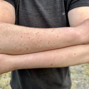 High midge numbers have been reported in the West of Scotland despite the sunny weather